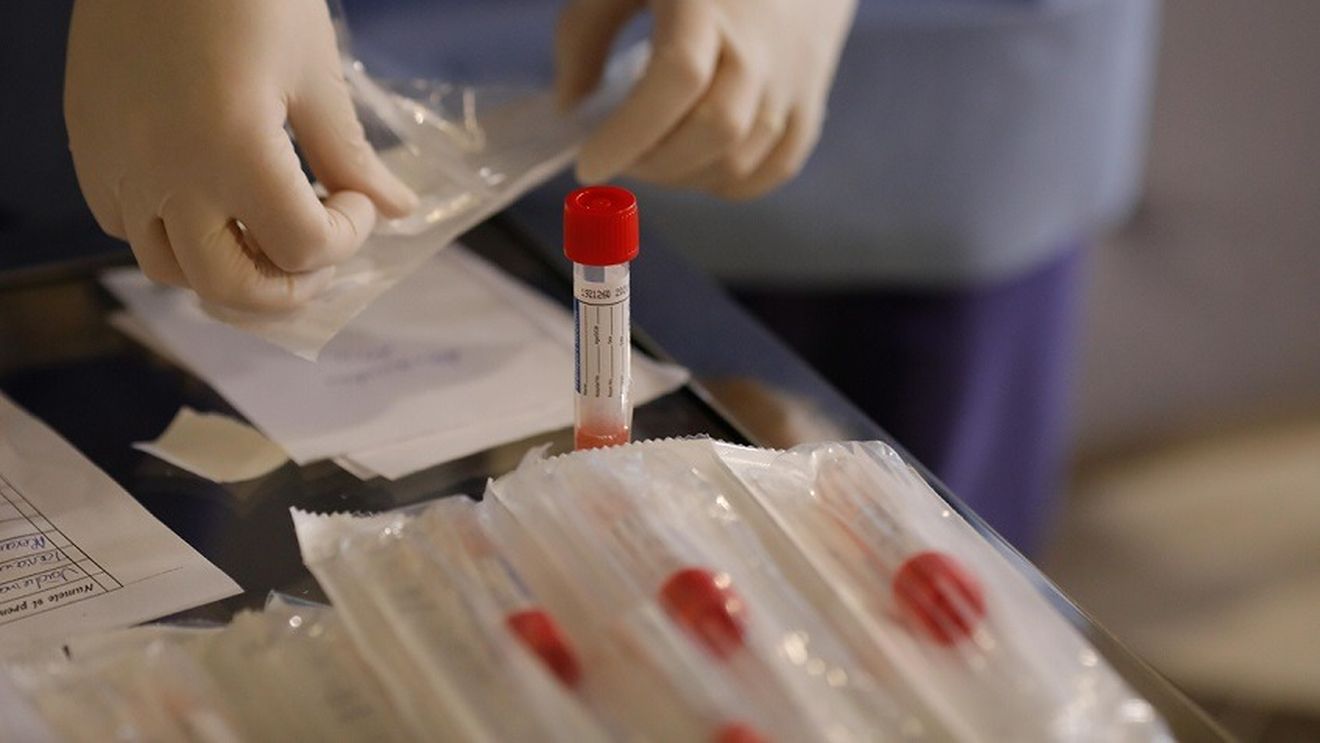 Cât costă testele Covid-19, după un an de pandemie